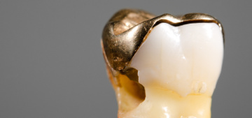 Wie viel Gold hat ein Zahn?
